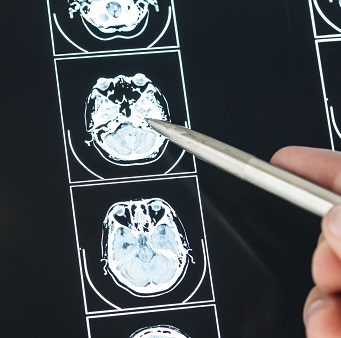 Radiology results